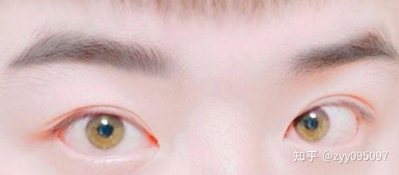 有和我一样天生绿眼睛的中国人么? - 知乎