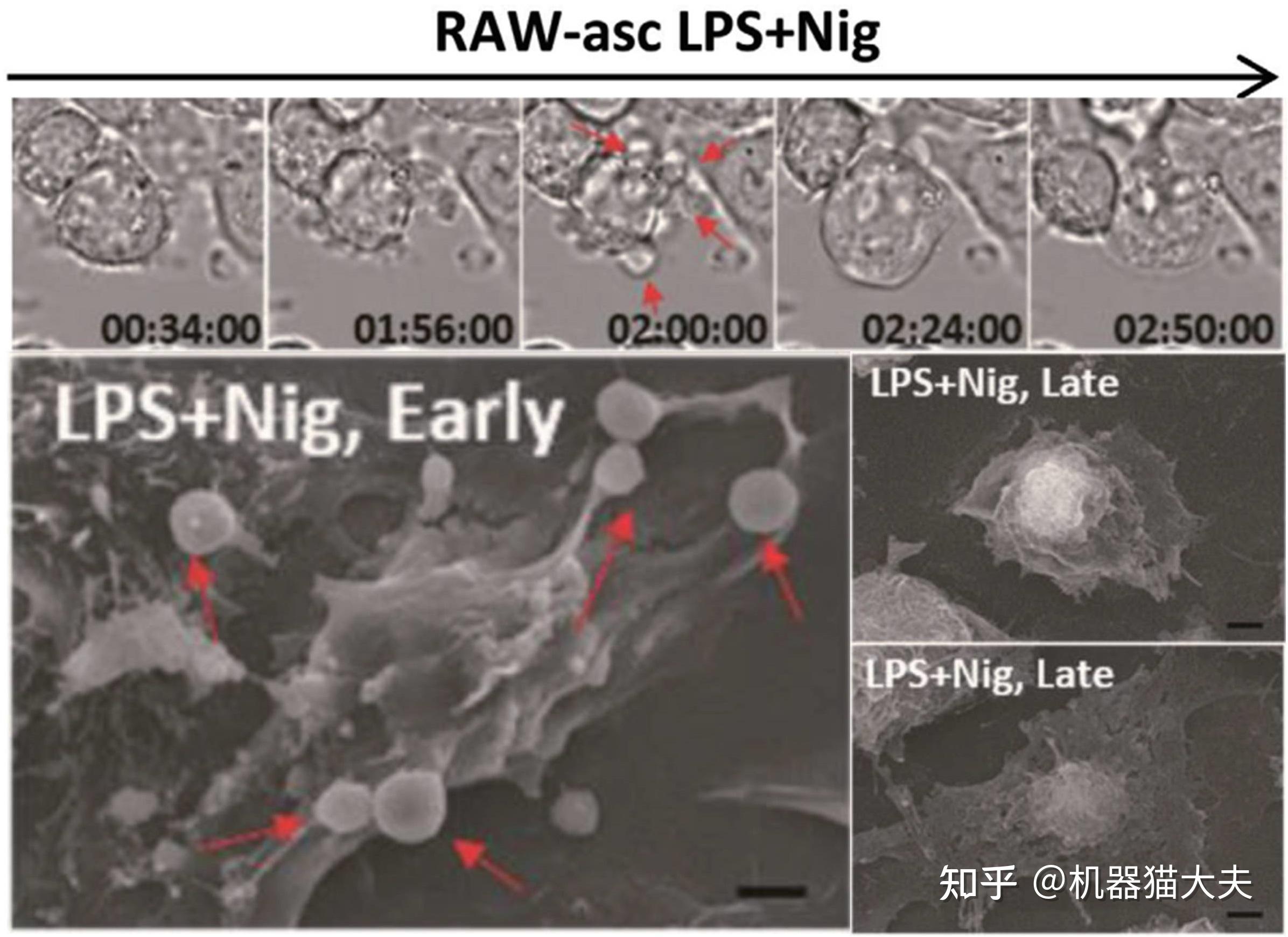细胞坏死性凋亡(necroptosis)都是程序性死亡(programmed cell death