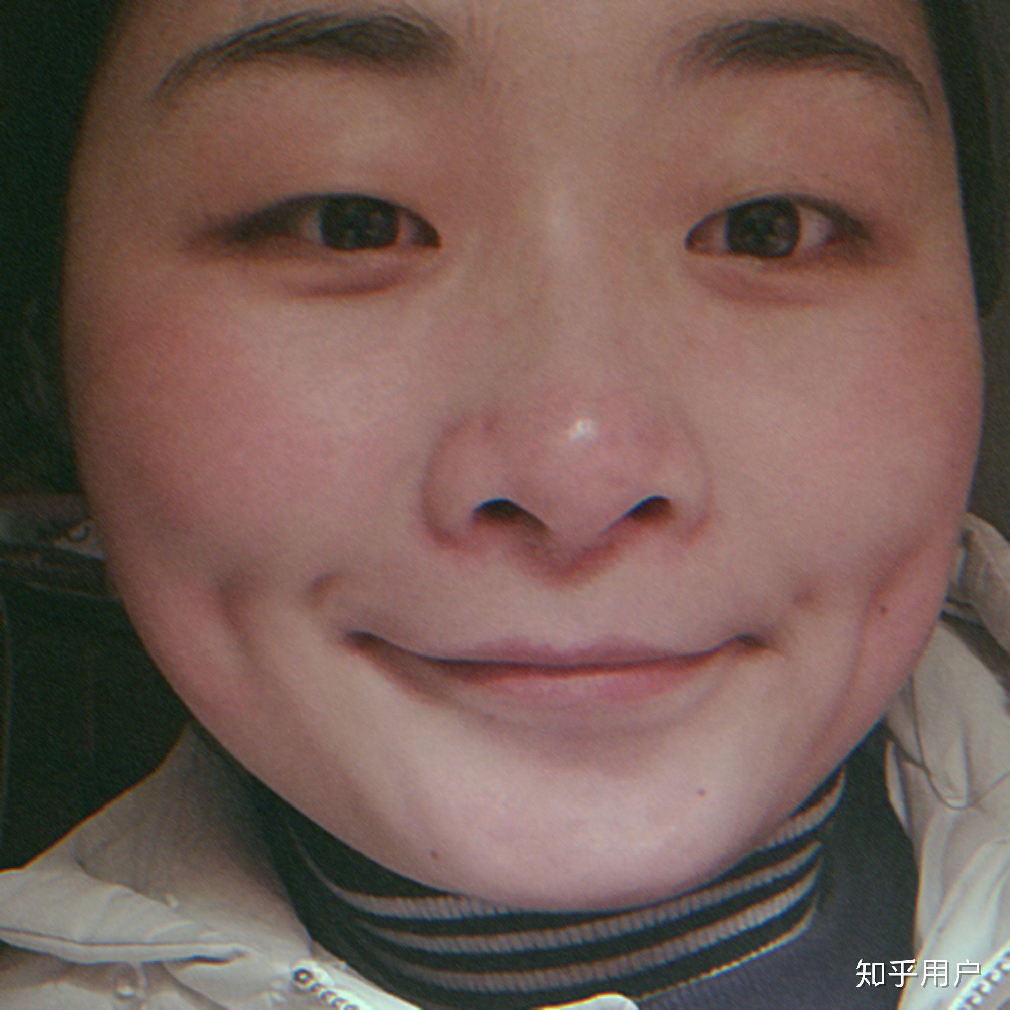 有四个酒窝是怎样一种体验