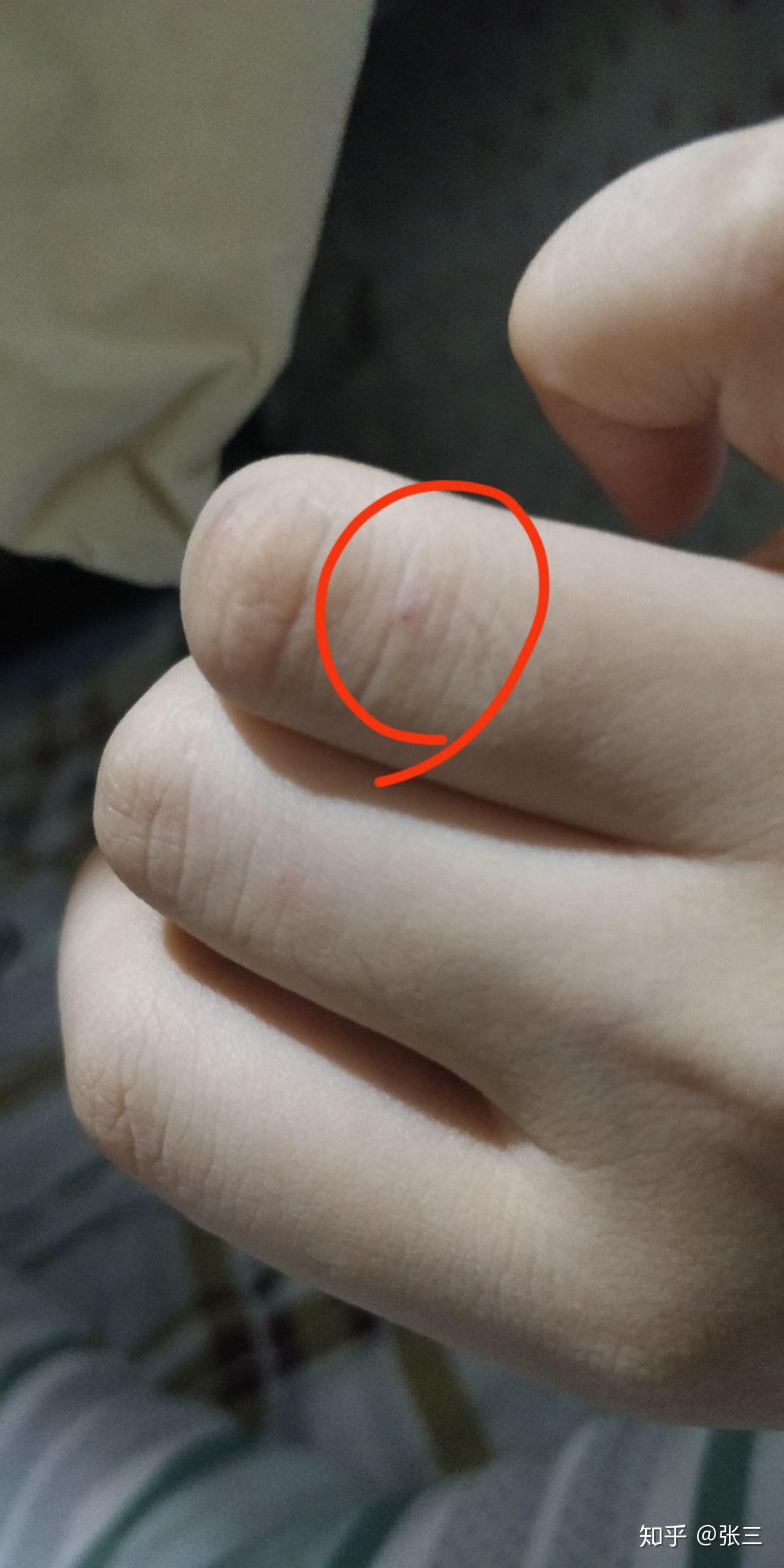这是狂犬病症状吗