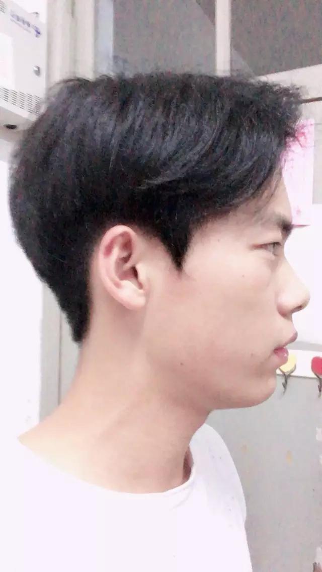 最直观的感受就是侧脸线条变的柔和好看了.甚至感觉鼻子都变高了.