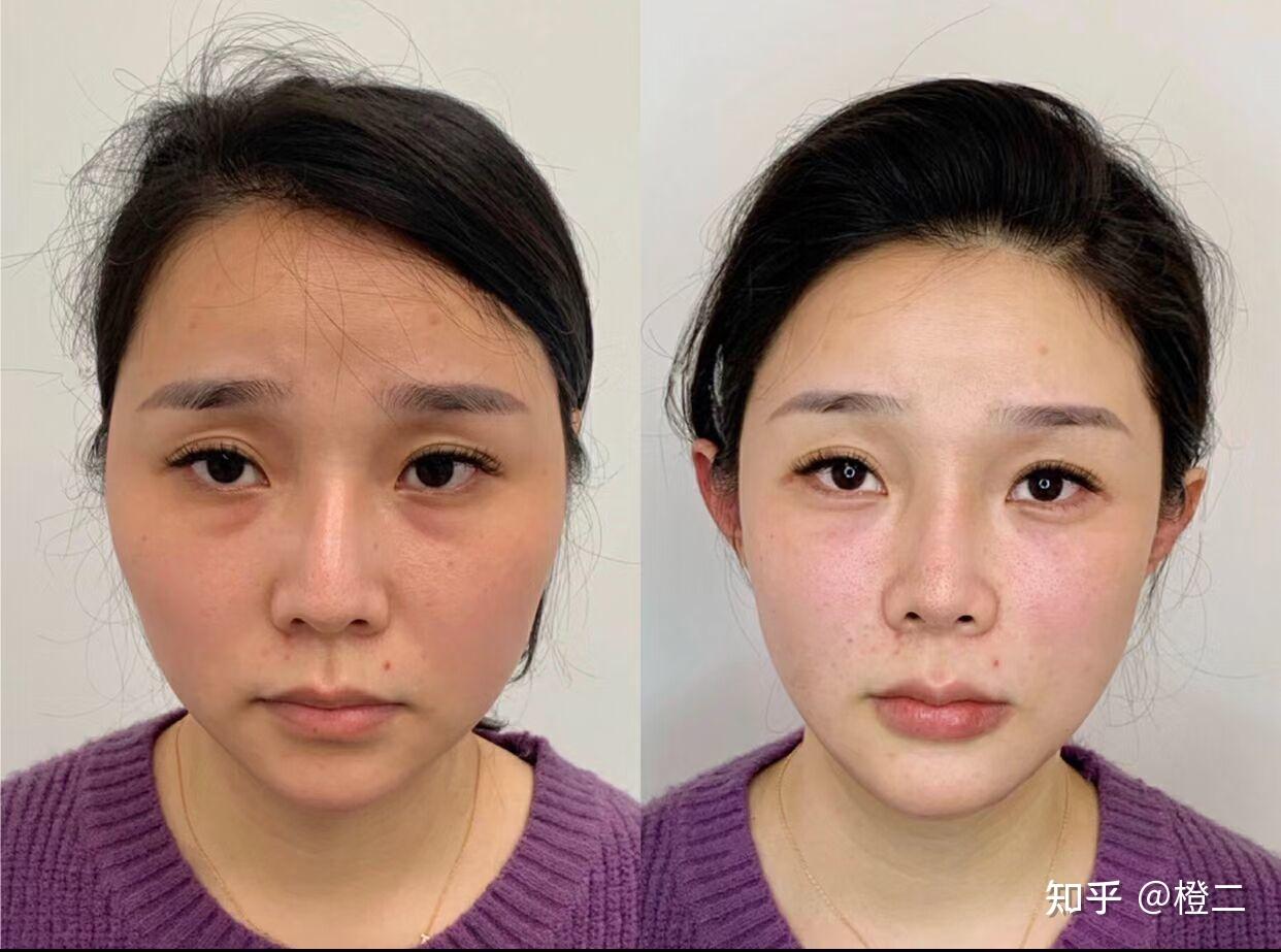 2,轮廓固定怎么做才能抗衰,去土气?