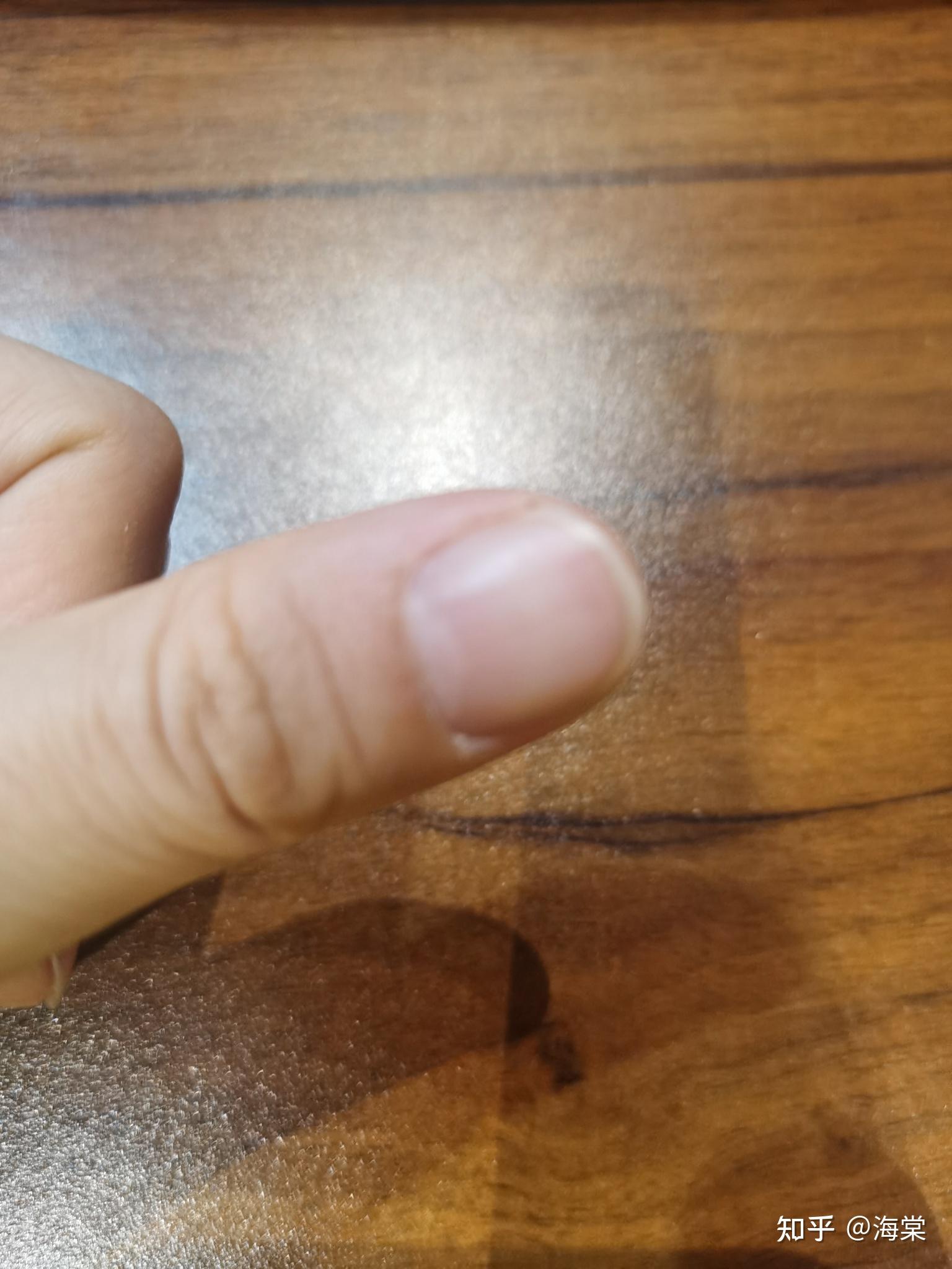 怎么让月牙白多起来