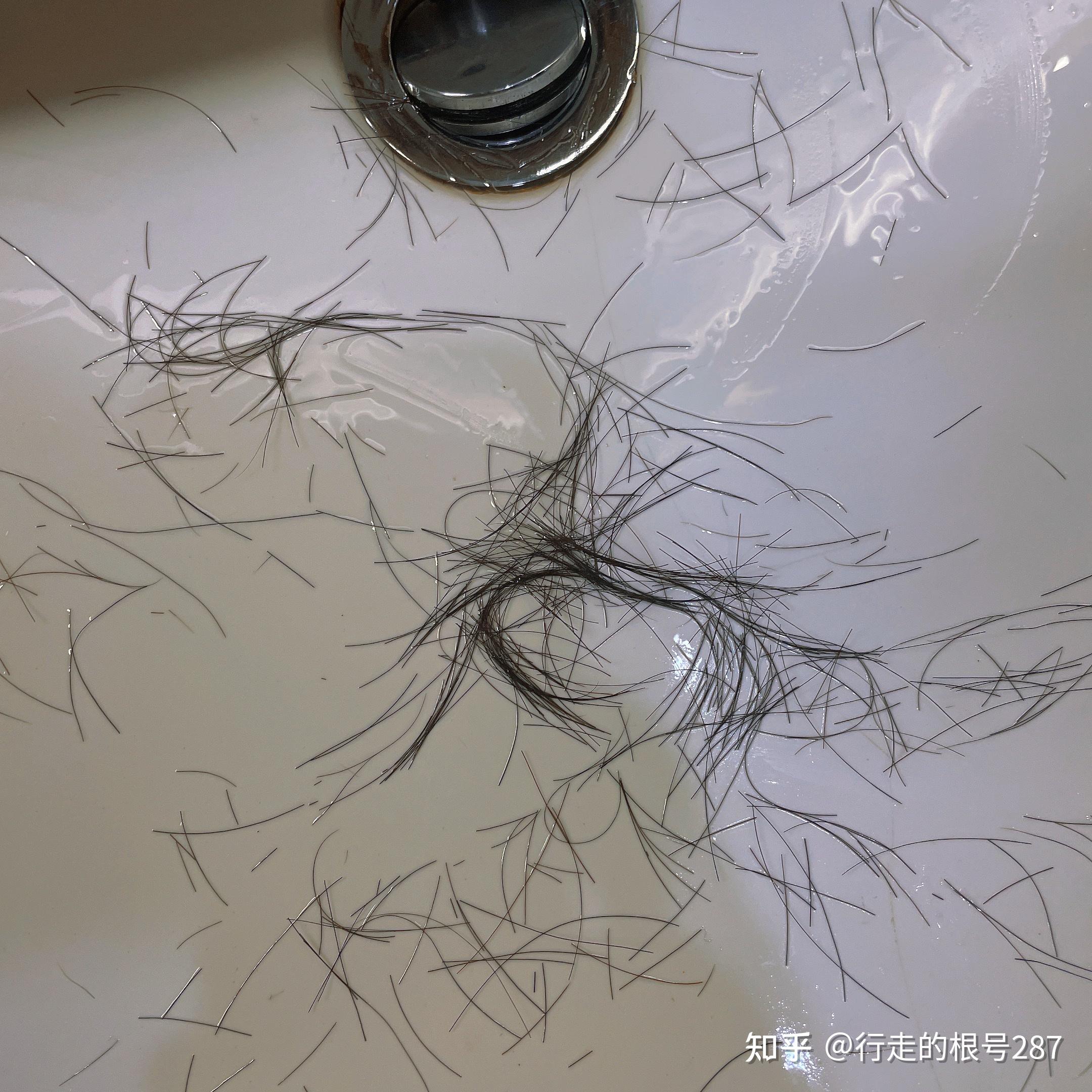 要说脱发,我很有经验,打工人压力大,996007天天熬夜每次洗头,头发掉的