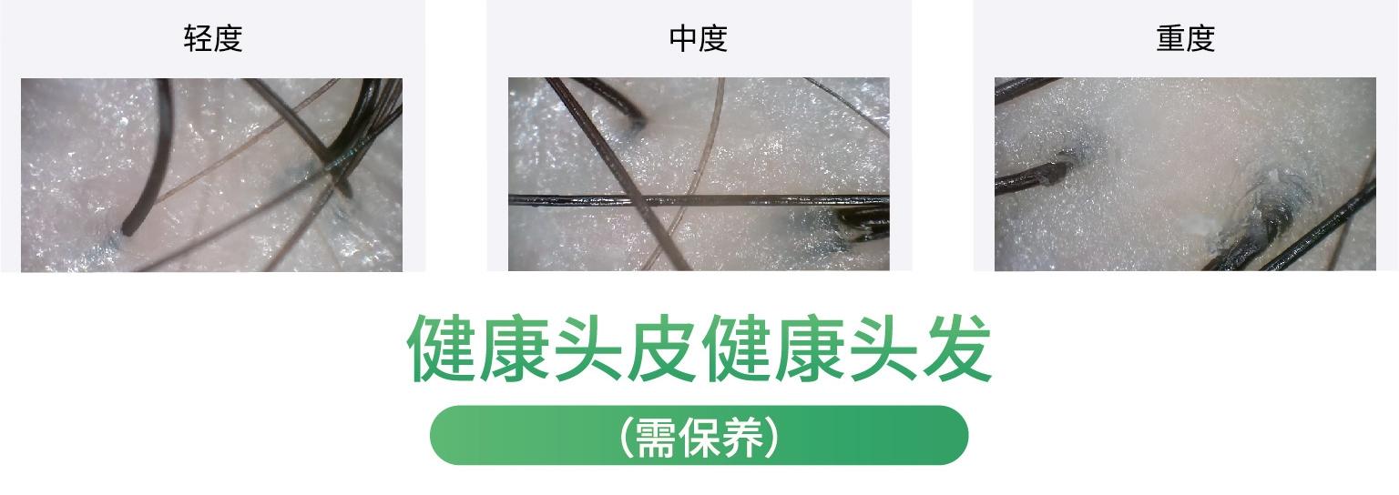 头皮问题|日常健康的头皮,为什么一到换季就头屑头痒 - 知乎