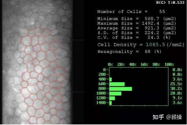 角膜内皮计数图片