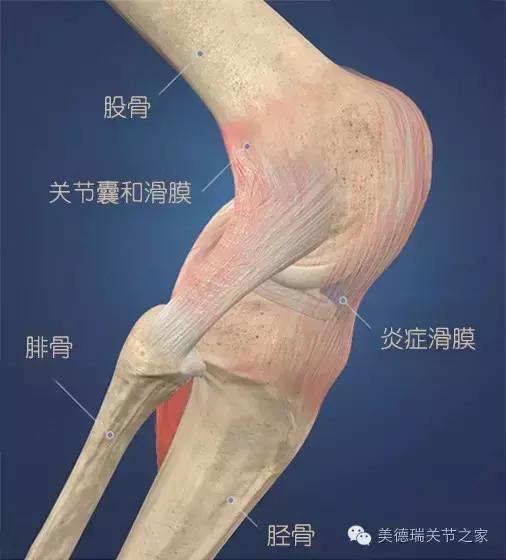 骨刺到底是不是病?长了骨刺该怎么办? - 知乎