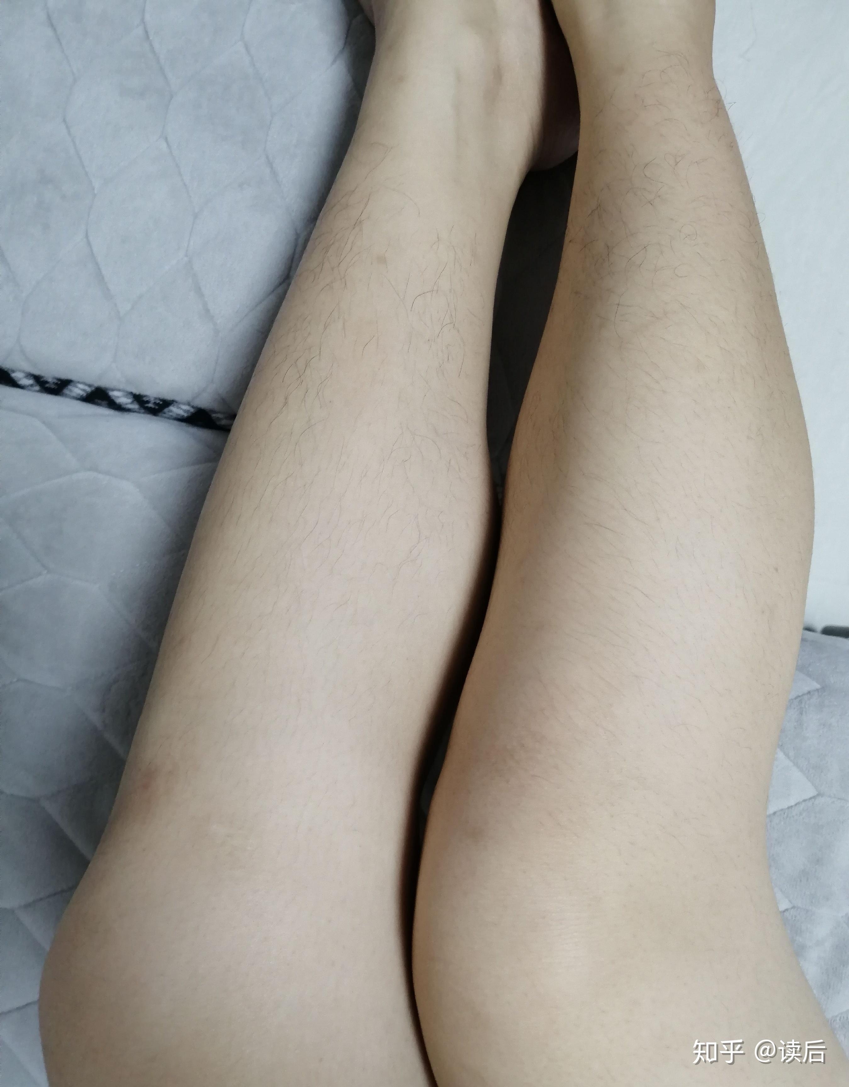 腿毛长的女生一定要脱毛吗?