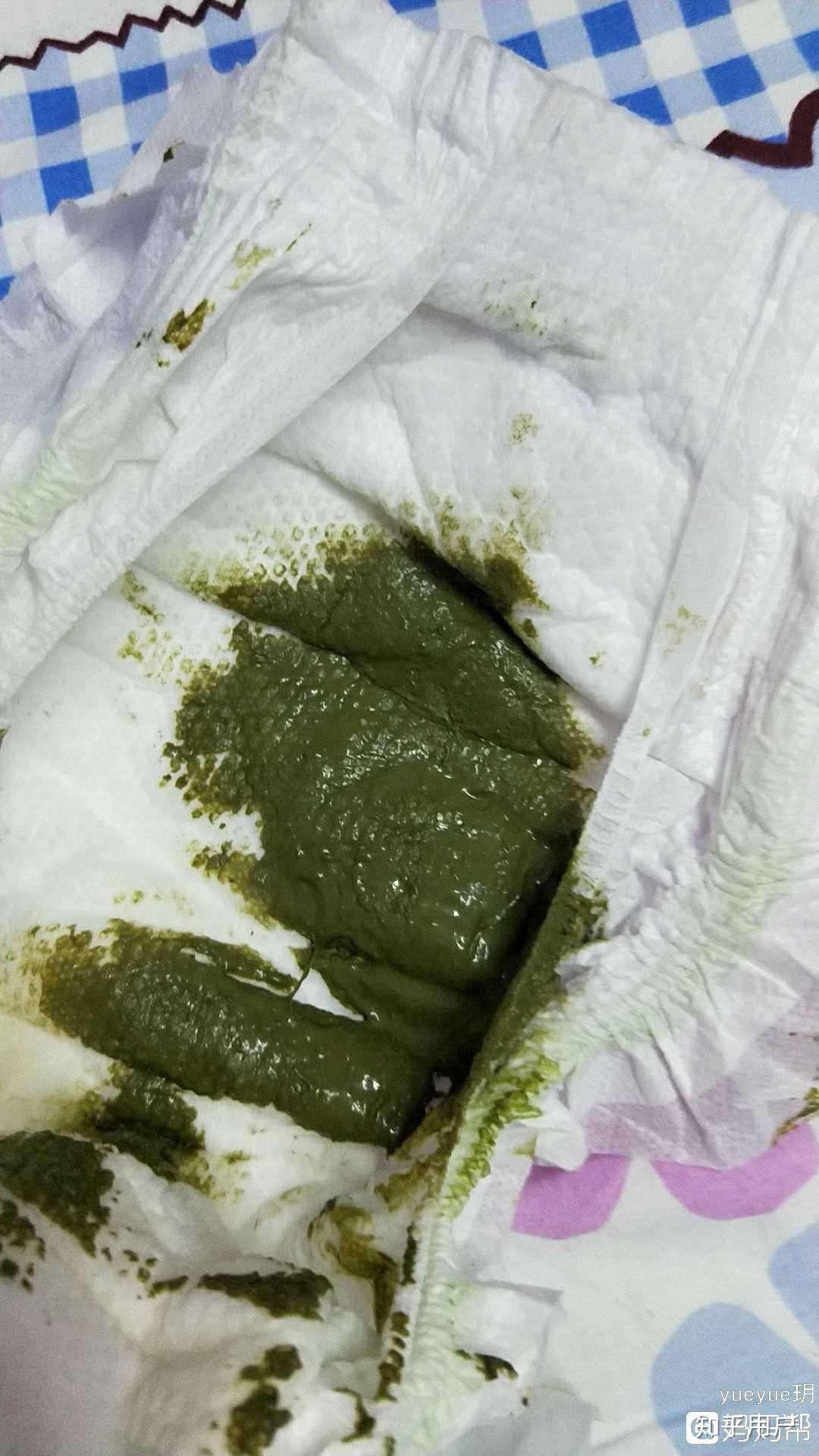 为什么孩子的大便总是绿色的? - 知乎