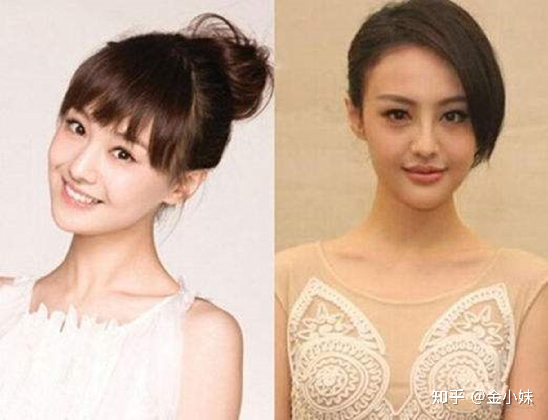 郑爽新剧肿成大s同款饼脸了!还被《奋斗》导演赵宝刚评价演技炸裂?