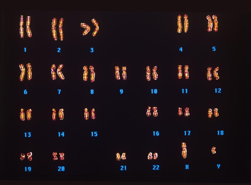 我们知道,染色体是细胞内具有遗传性质的遗传物质深度压缩形成的聚合