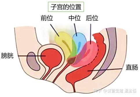 怀孕子宫位置示意图图片