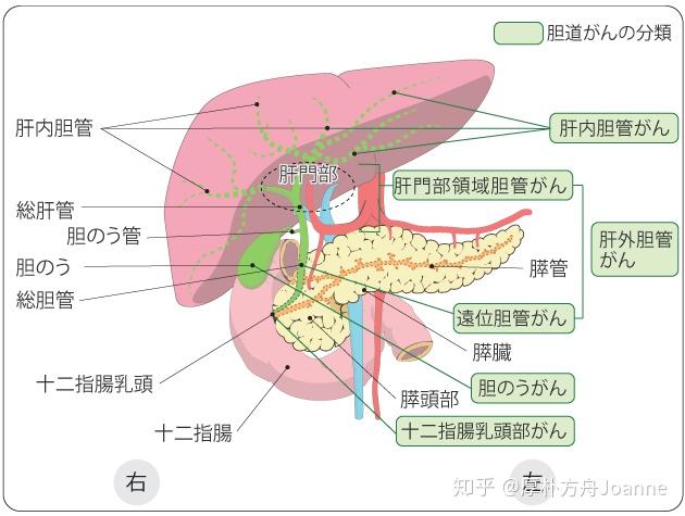 生存率低预后差的胆囊癌治愈率,怎么治疗才能提高治愈率 知乎