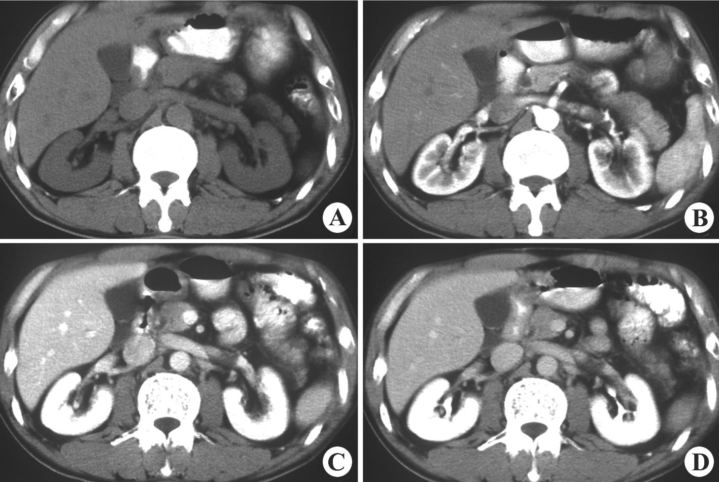 泌尿系统1 - 知乎