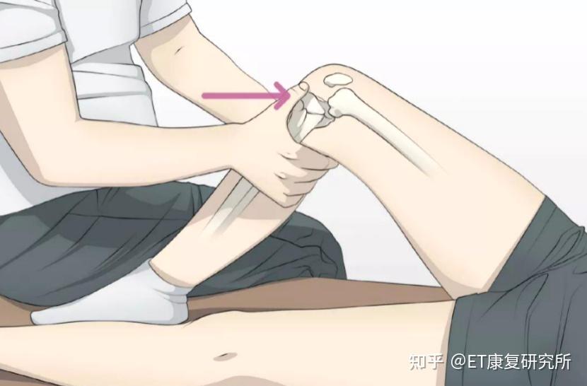 术后康复|后交叉韧带术后康复指南