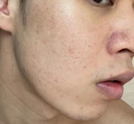 皮下男 zhuanlan.zhihu.com