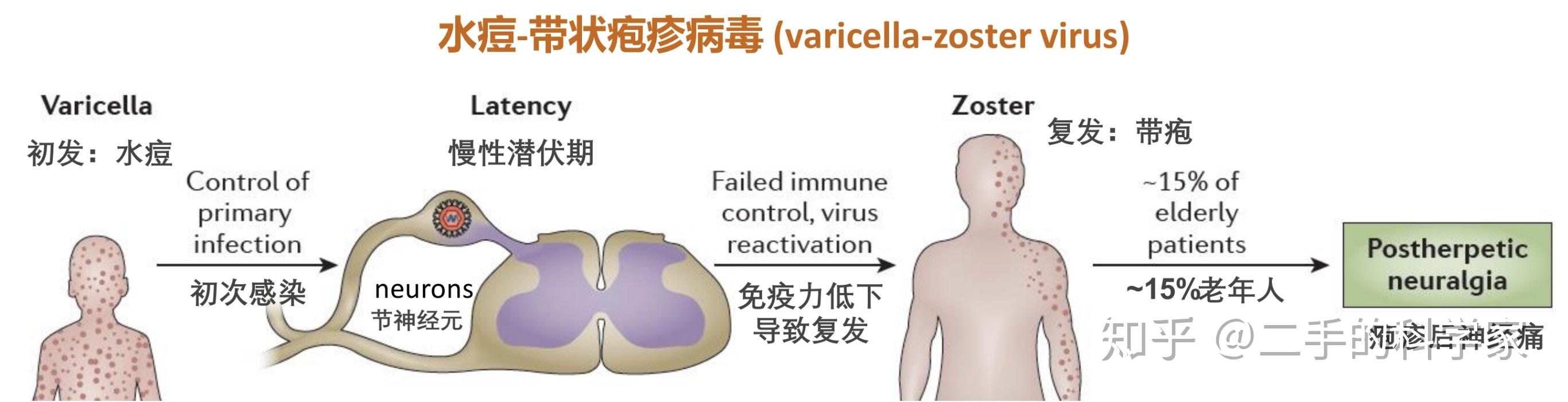 為什麼水痘帶狀皰疹這種病毒會有兩個疫苗分別針對水痘和帶狀皰疹