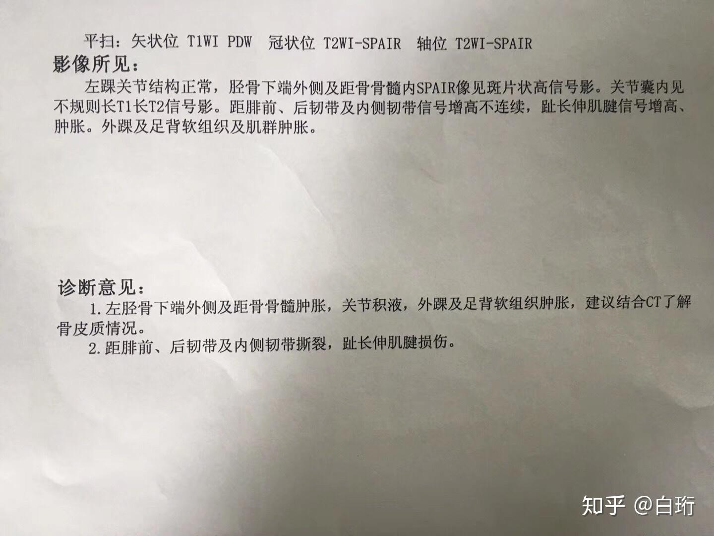 脚崴了伤到筋,4个月都没好? - 知乎