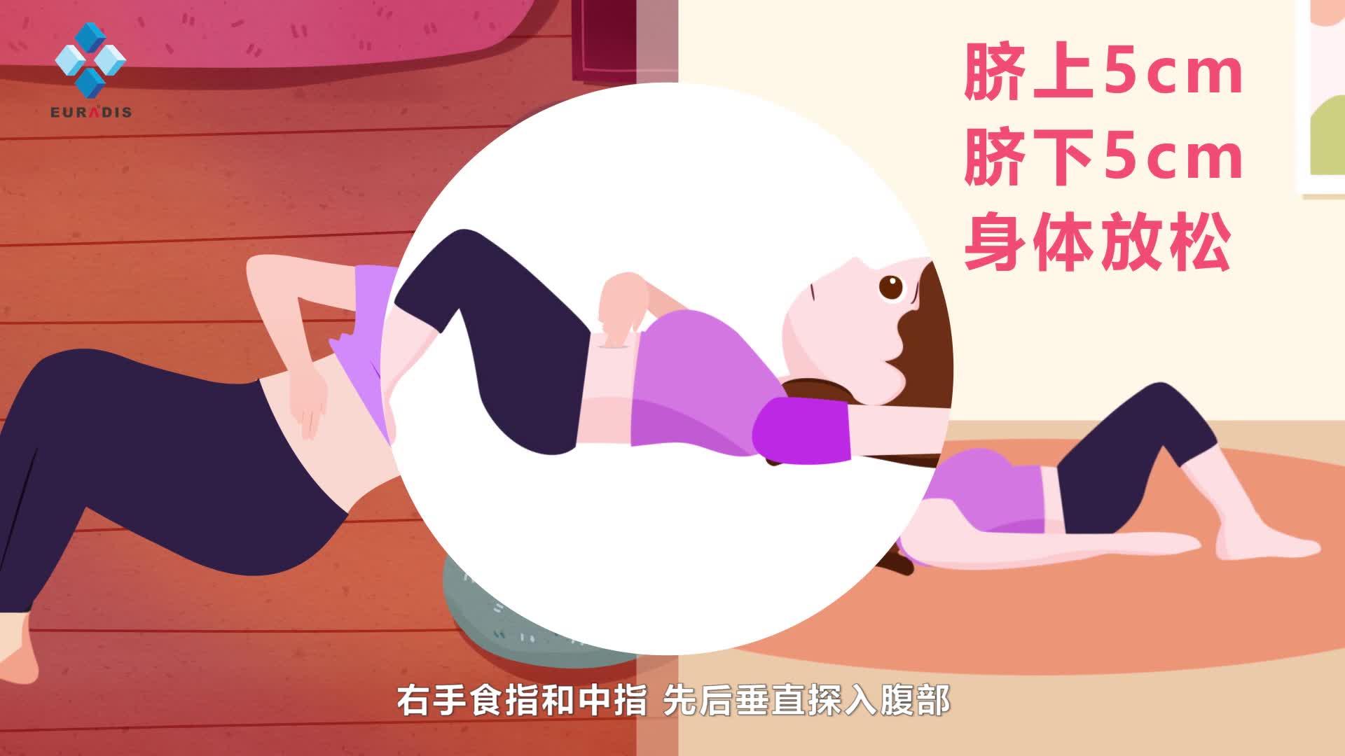 腹直肌分离手法处理第二步腹直肌放松