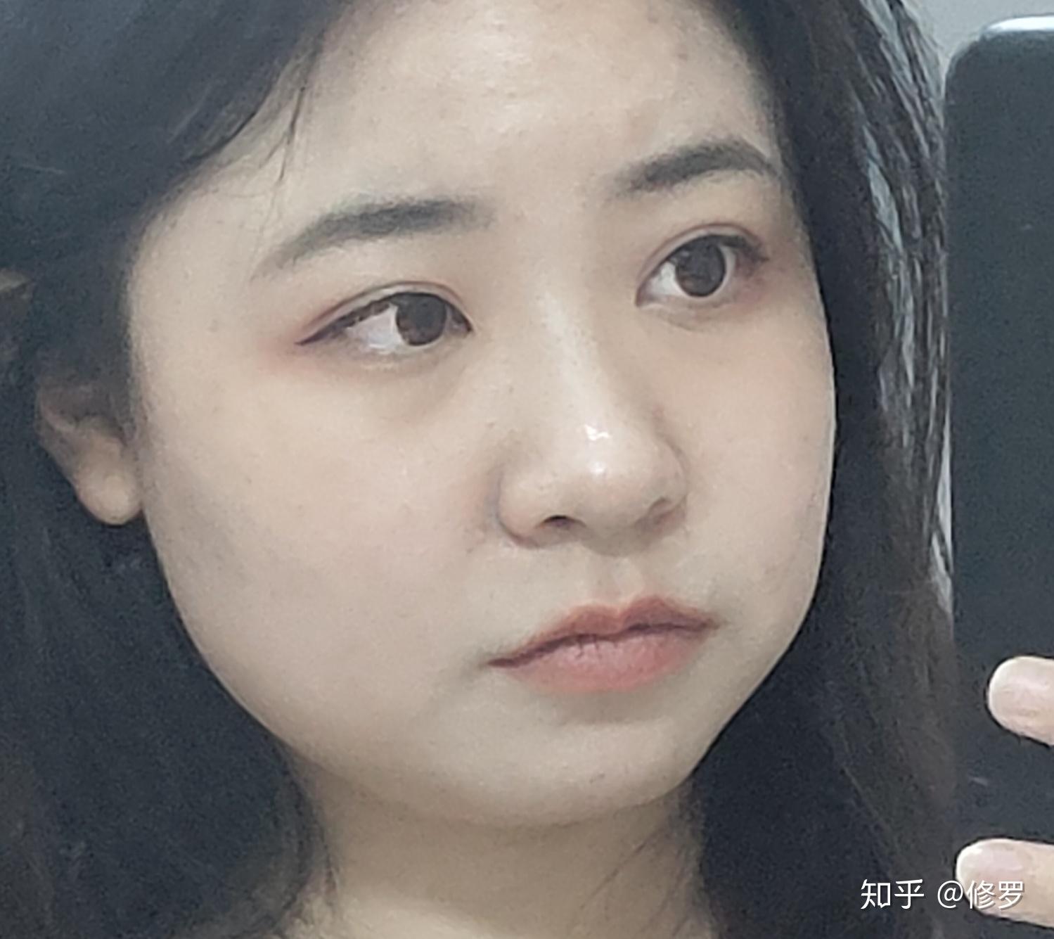脸大而且颧骨宽下巴短是种什么体验,哭唧唧? - 知乎