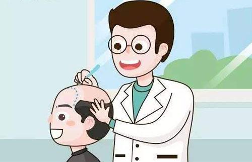 毛发检测多少正常 v2-eecf3fdd49dc73ea03036650572e8d54_1440w.jpg?source=172ae18b