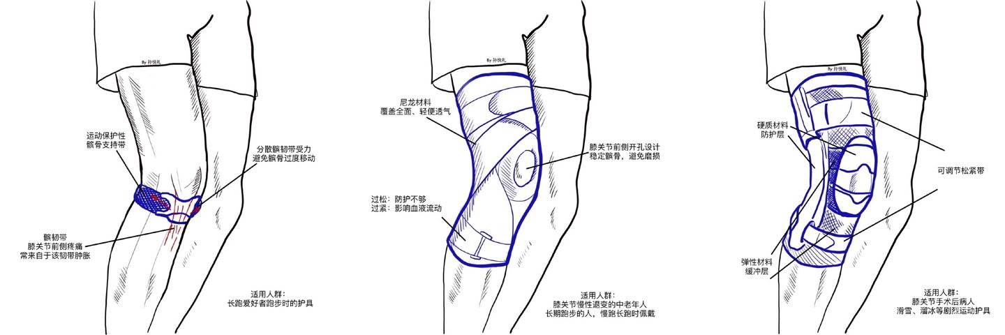 如何科学选用护膝 知乎