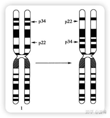 3.5.2 染色体结构畸变 - 知乎