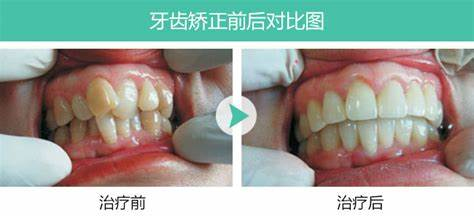 怎样挑选银耳的正确方法 v2-eef204a6f7bdf3bf67d42458d240c621_1440w.jpg?source=172ae18b