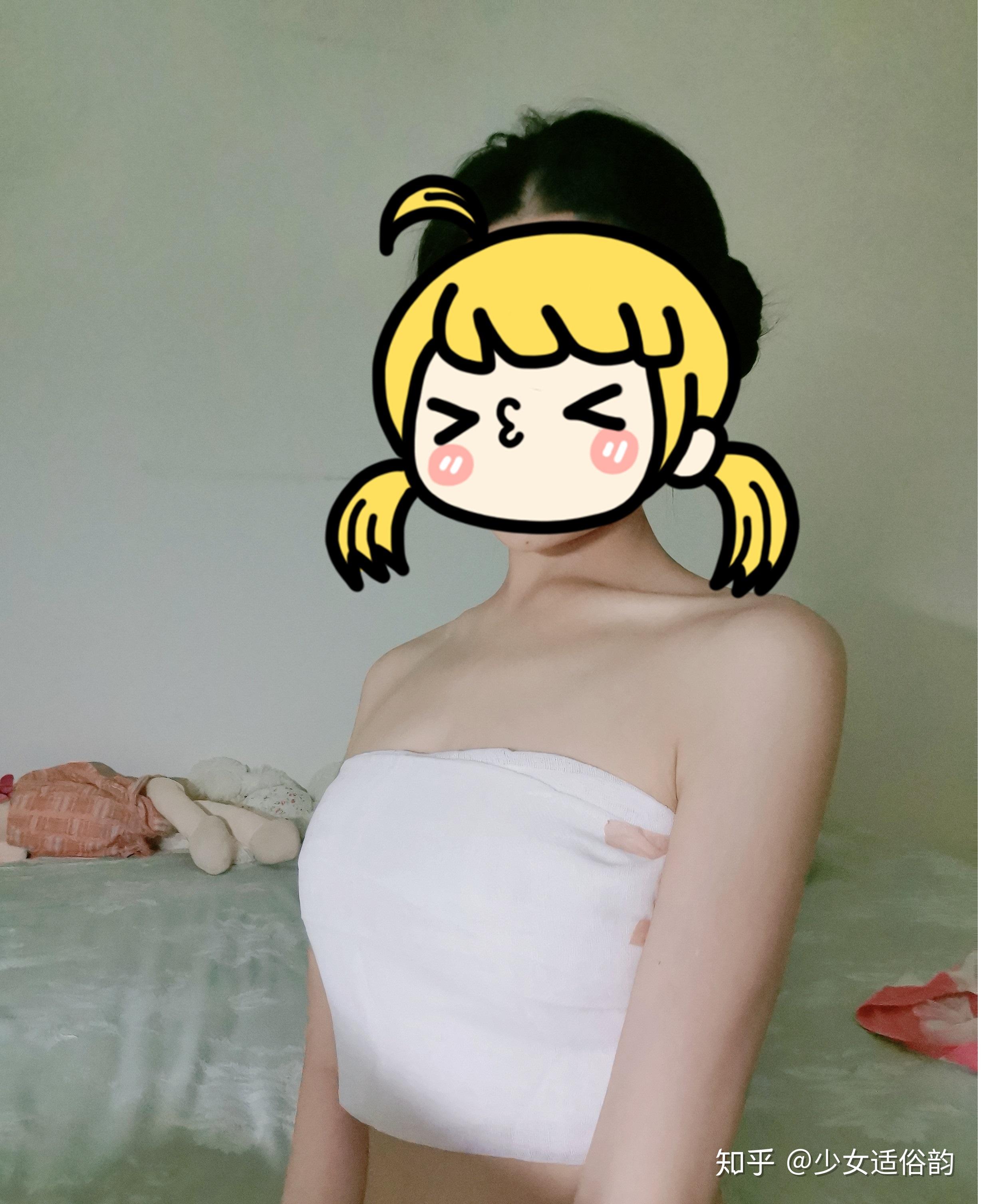 曼陀假体隆胸第五天回家回家