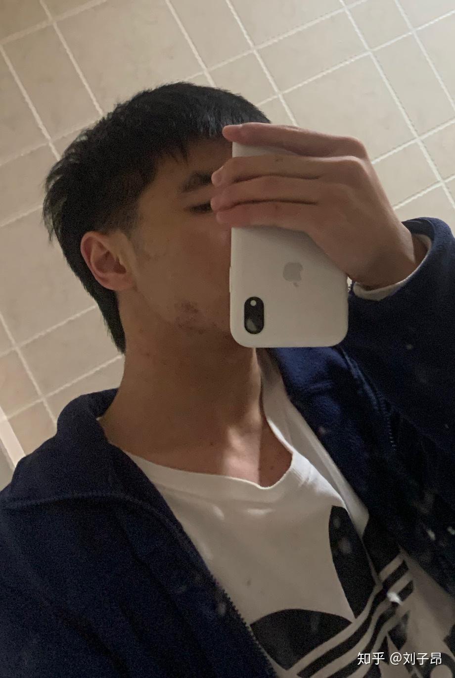 我这样子的刚留一个月,留成还需要多久?刘子昂