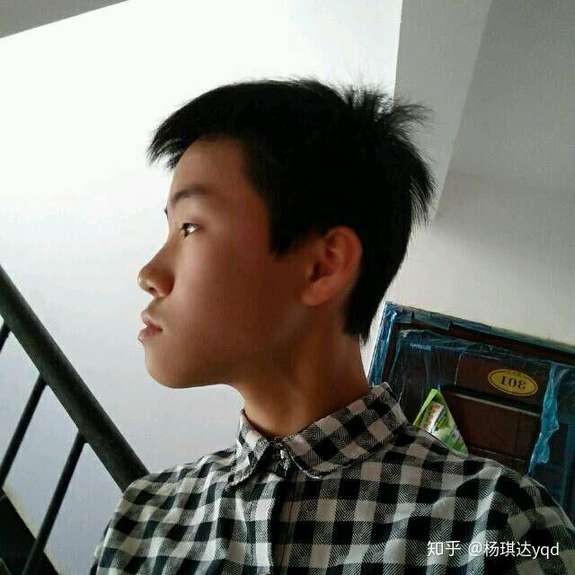 牙齿地包天兜齿是怎样的一种体验