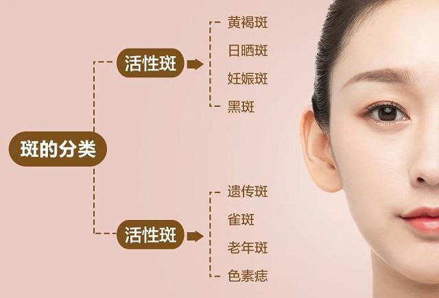 怎么祛斑 知乎