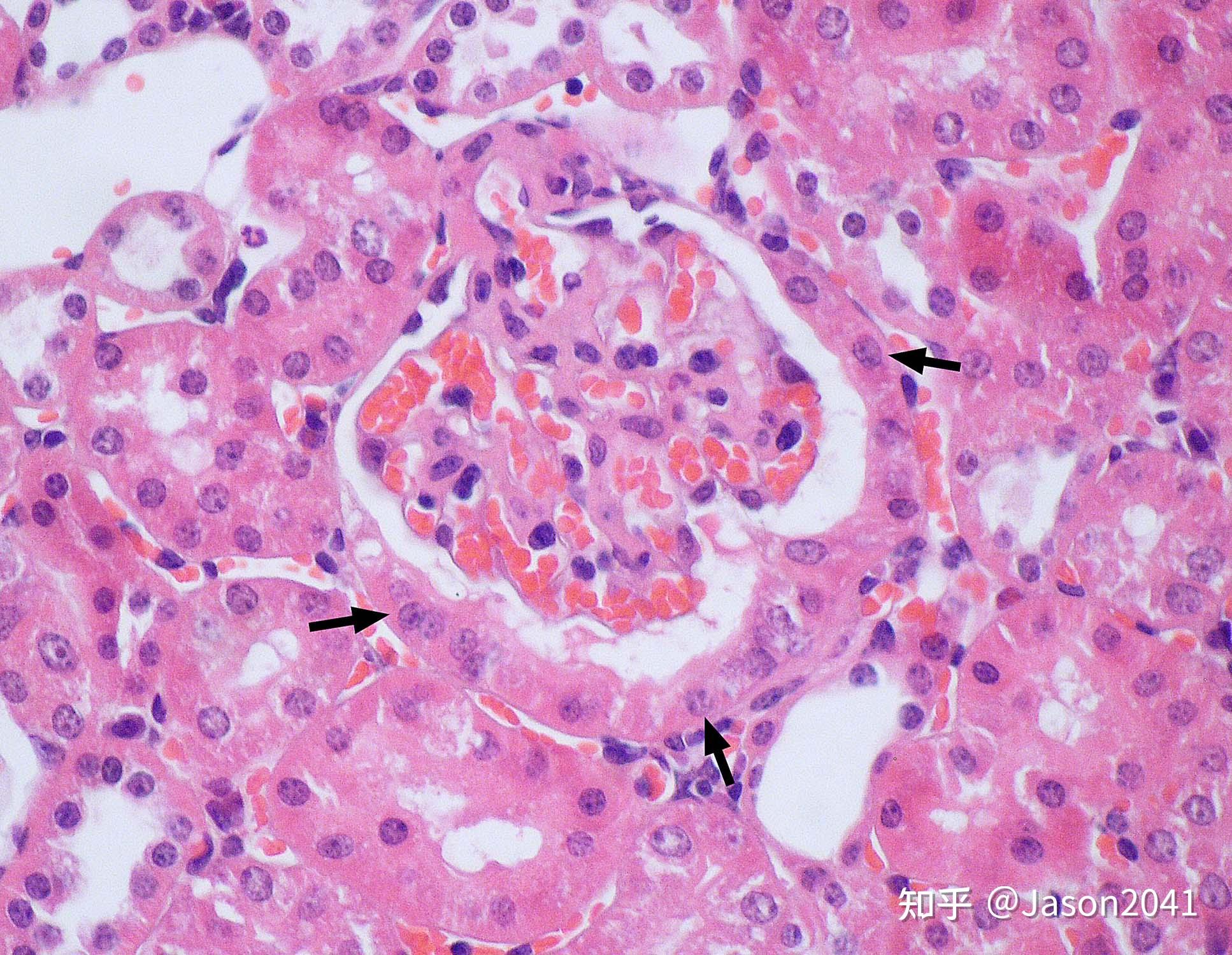 肾切片显微镜下结构描述？ - 知乎