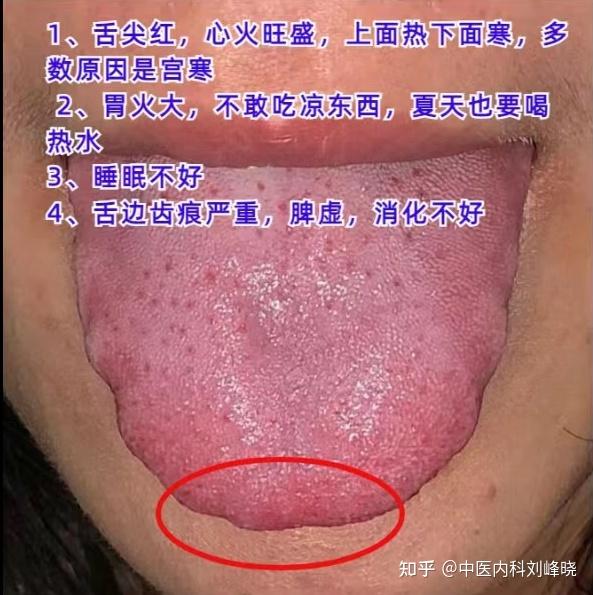 今日舌诊———实战分析 - 知乎