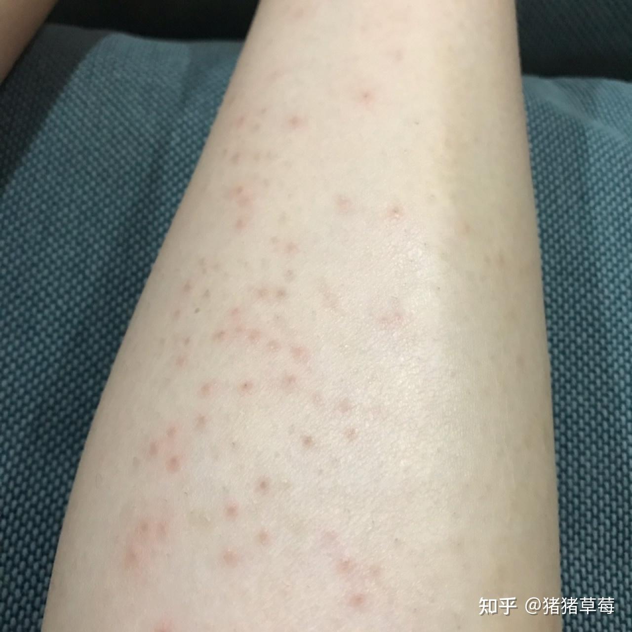 什么牌子的脱毛膏脱完没有黑点?