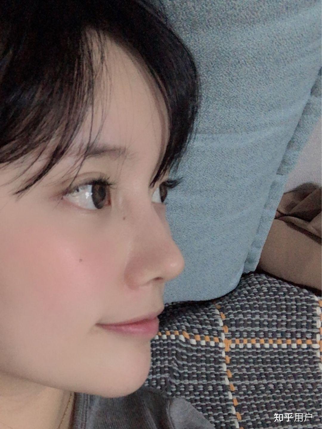 想做半肋硅胶修复全国哪些医生隆鼻做的比较好