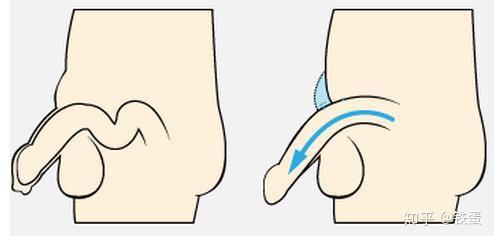 有哪些切实可行的大幅增大阴茎尺寸的办法? - 知乎