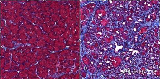 gastroenterology鑑別出阻斷胰腺被自身消化的特殊蛋白質