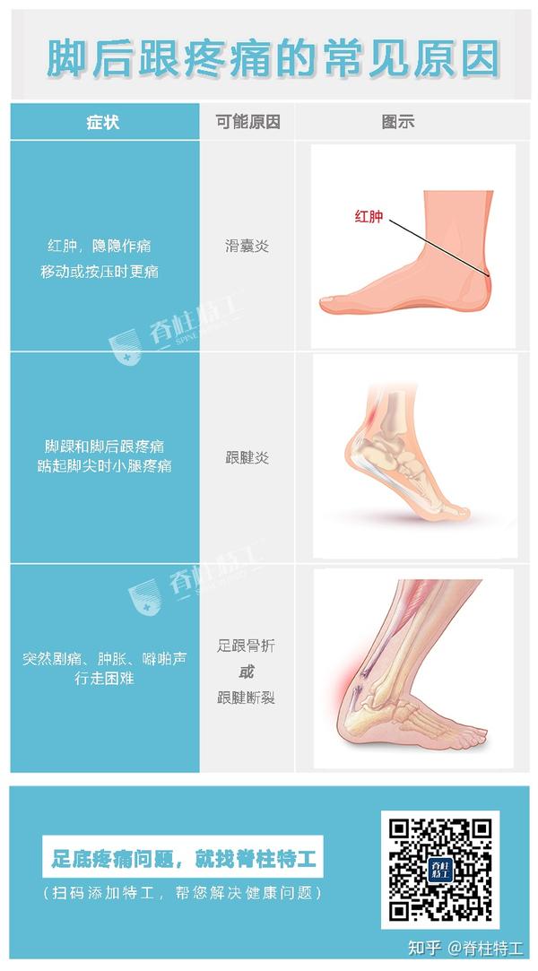 【足部疼痛地图】教你看懂脚痛对应的常见病症 - 知乎