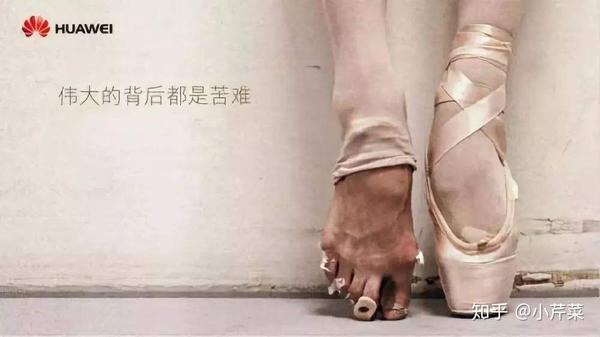 芭蕾舞者的脚到底是什么样的 知乎