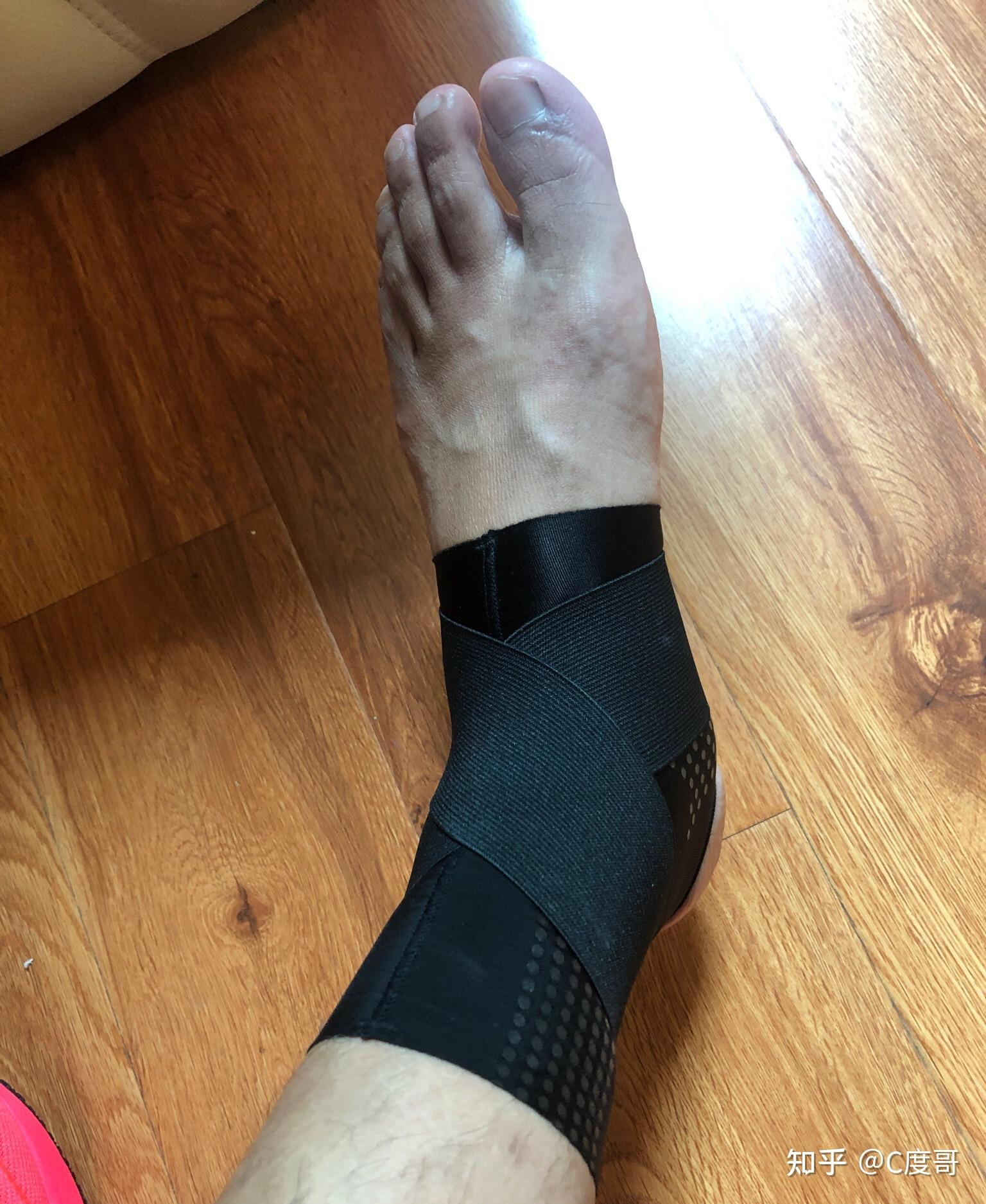 左距腓前韧带完全撕裂康复日记1010更新
