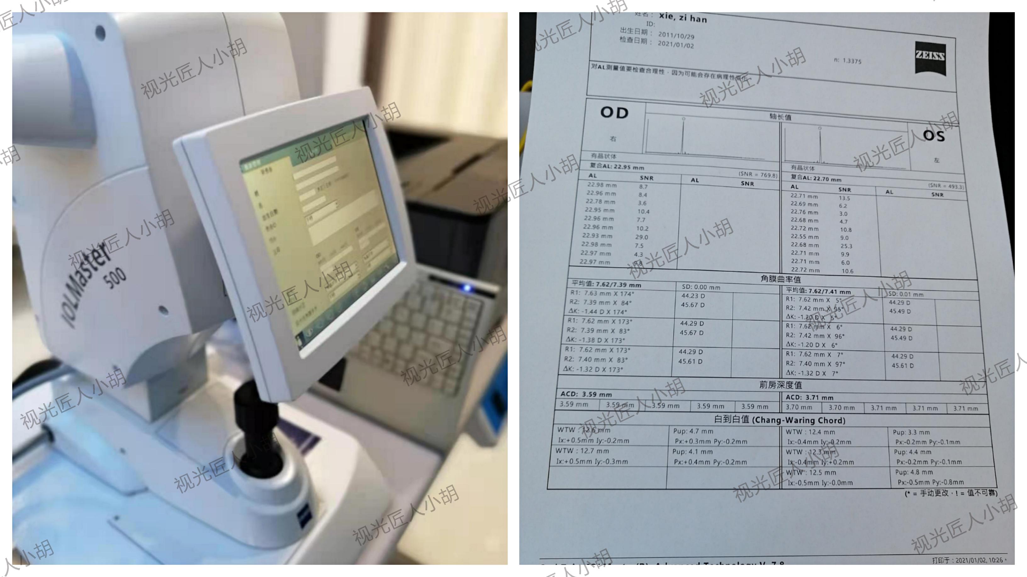 孩子配眼镜需要测眼轴需要使用生物测量仪吗