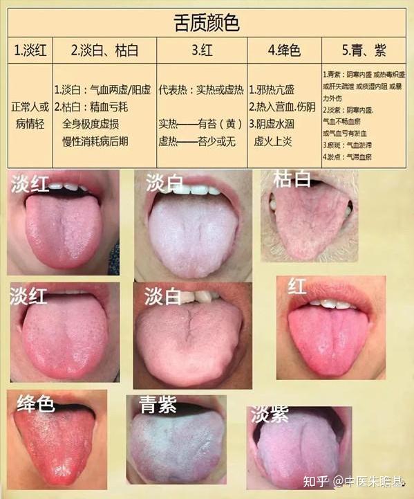 舌诊一看就明了 - 知乎