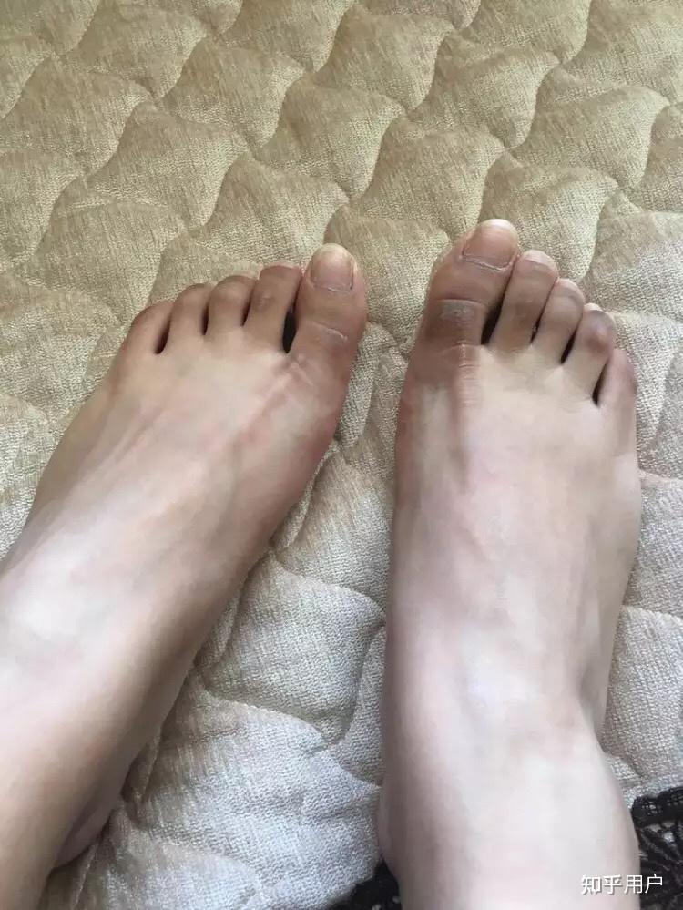 有没有赤脚外出的经历