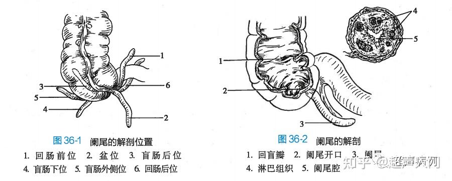 (6)结肠充气试验(rovsing征:急性阑尾炎时可阳性,但阴性不能排除诊断