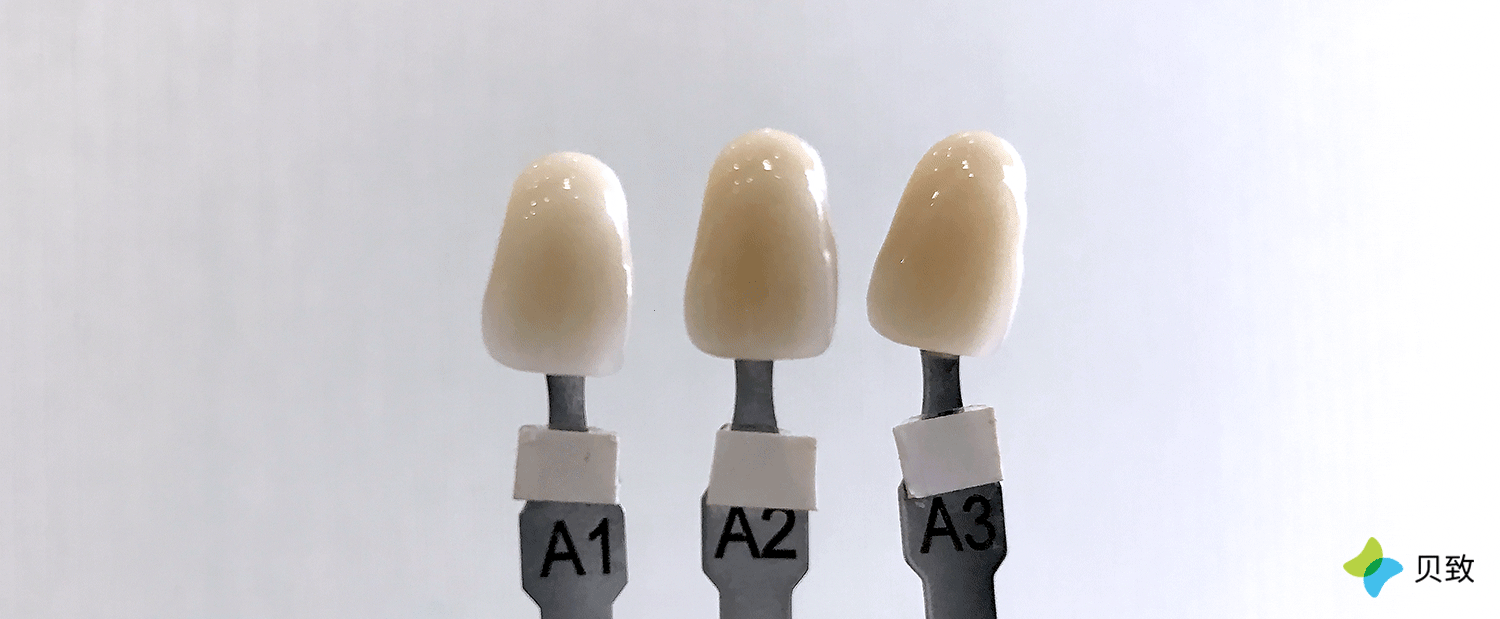 我们称之为 vita 色阶:由黄到白,等级越高,牙齿越亮白.