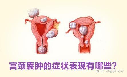 半岛体育下载：子宫肌瘤患者如何治疗