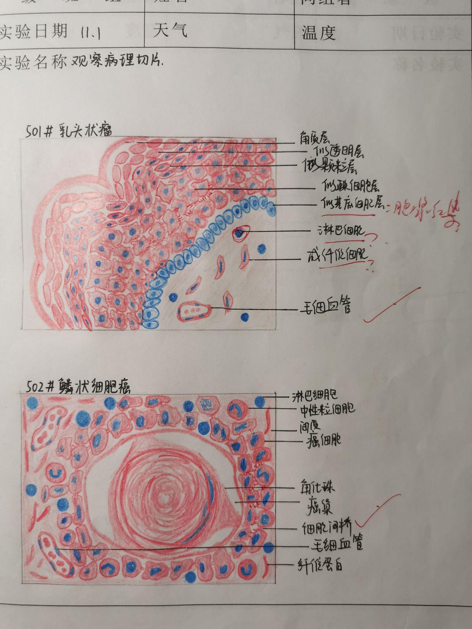 病理实验红蓝铅笔手绘图 