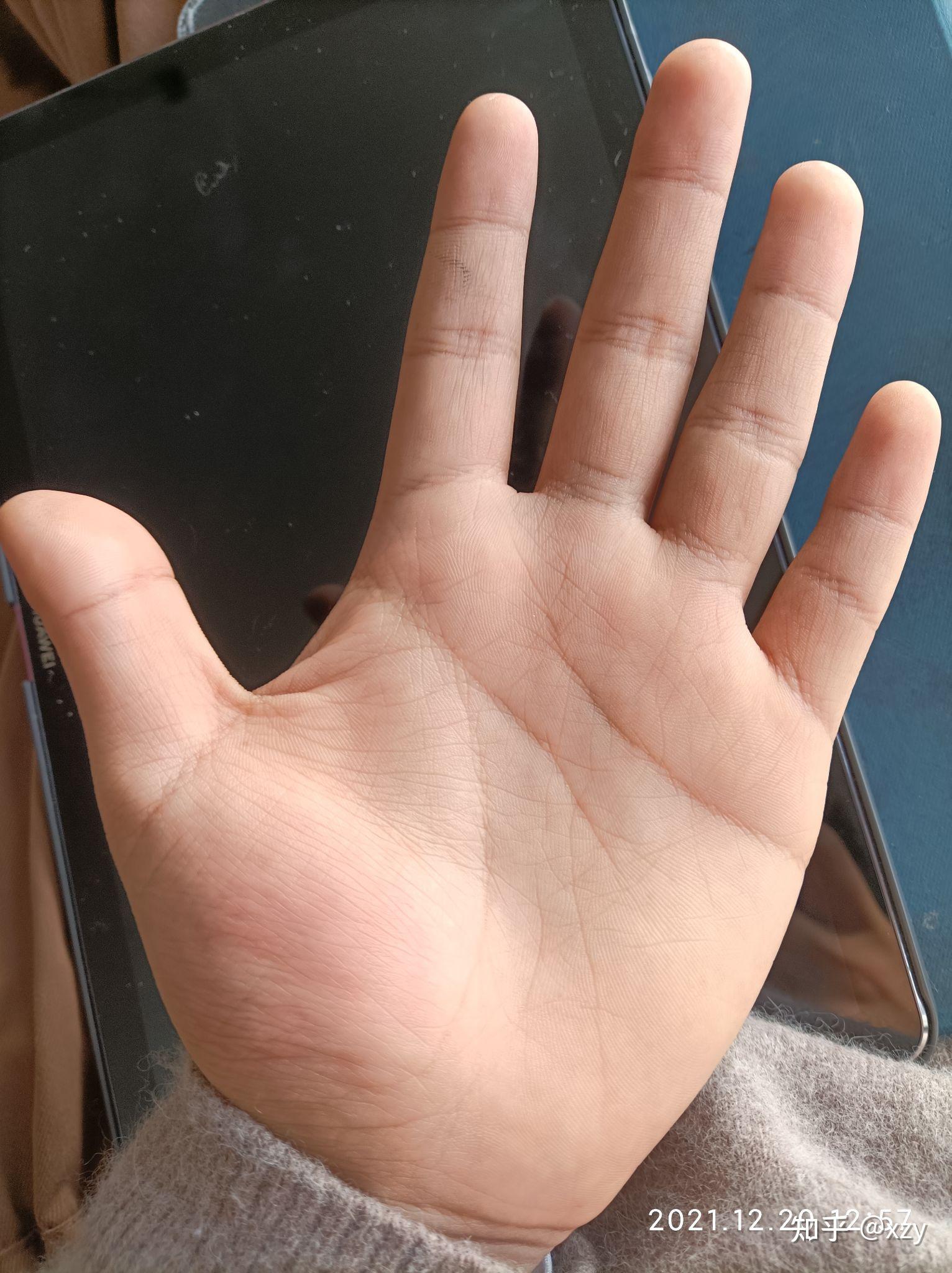 手掌大手指短是一种什么体验? - 知乎