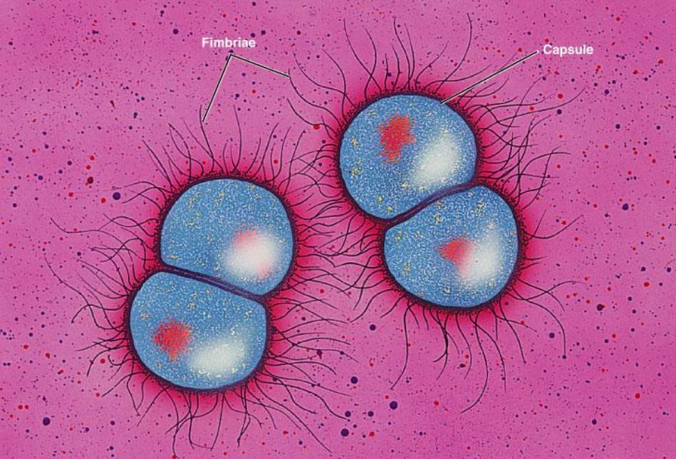 性病科普 淋病 Gonorrhea 知乎